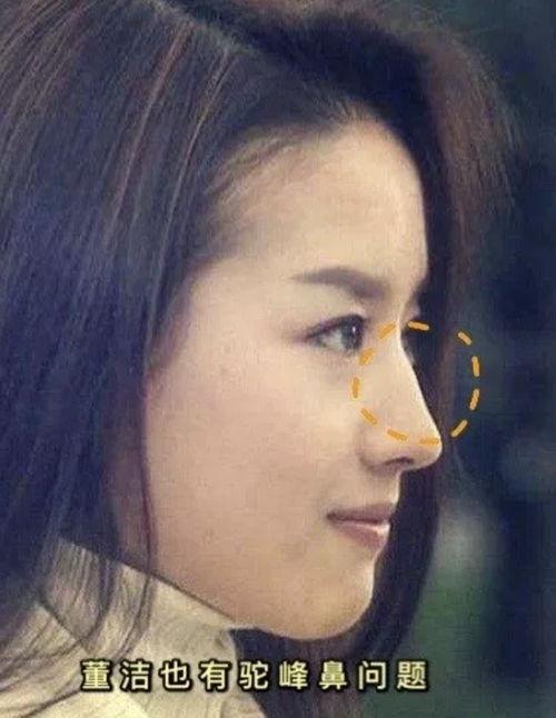 明星驼峰鼻,揭秘驼峰鼻的独特魅力